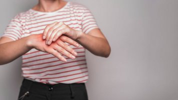 Příběh Renáty (35): Můj život s atopickým ekzémem