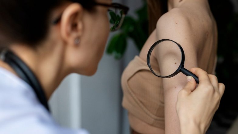 Kůže má dlouhou paměť