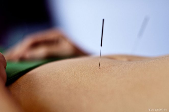 Čínská nebo klasická medicína?